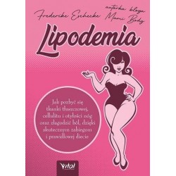 Lipodemia